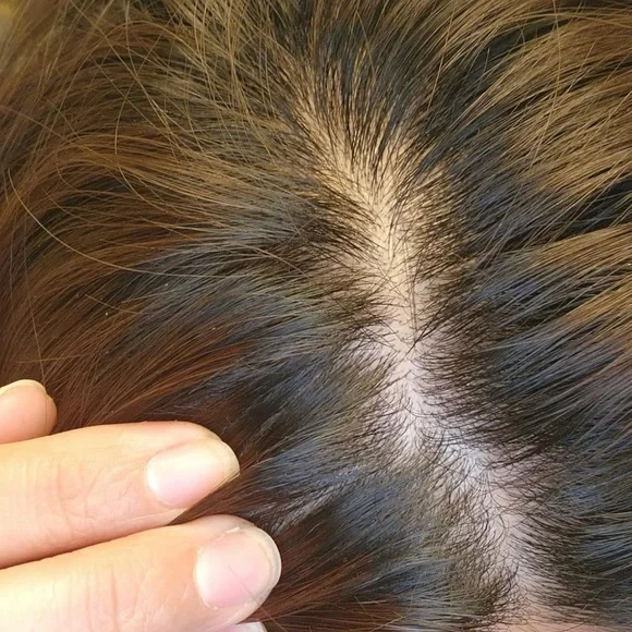 Nizoral Anti-Dandruff Shampoo - Picture 4 of 4